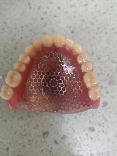 西宁牙齿修复 西宁牙齿修复